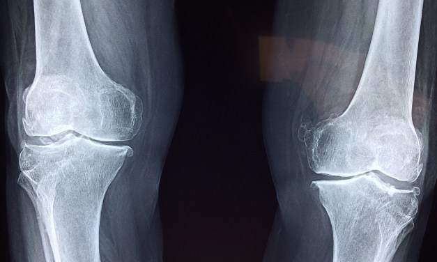 What are the most common injuries in MMA?